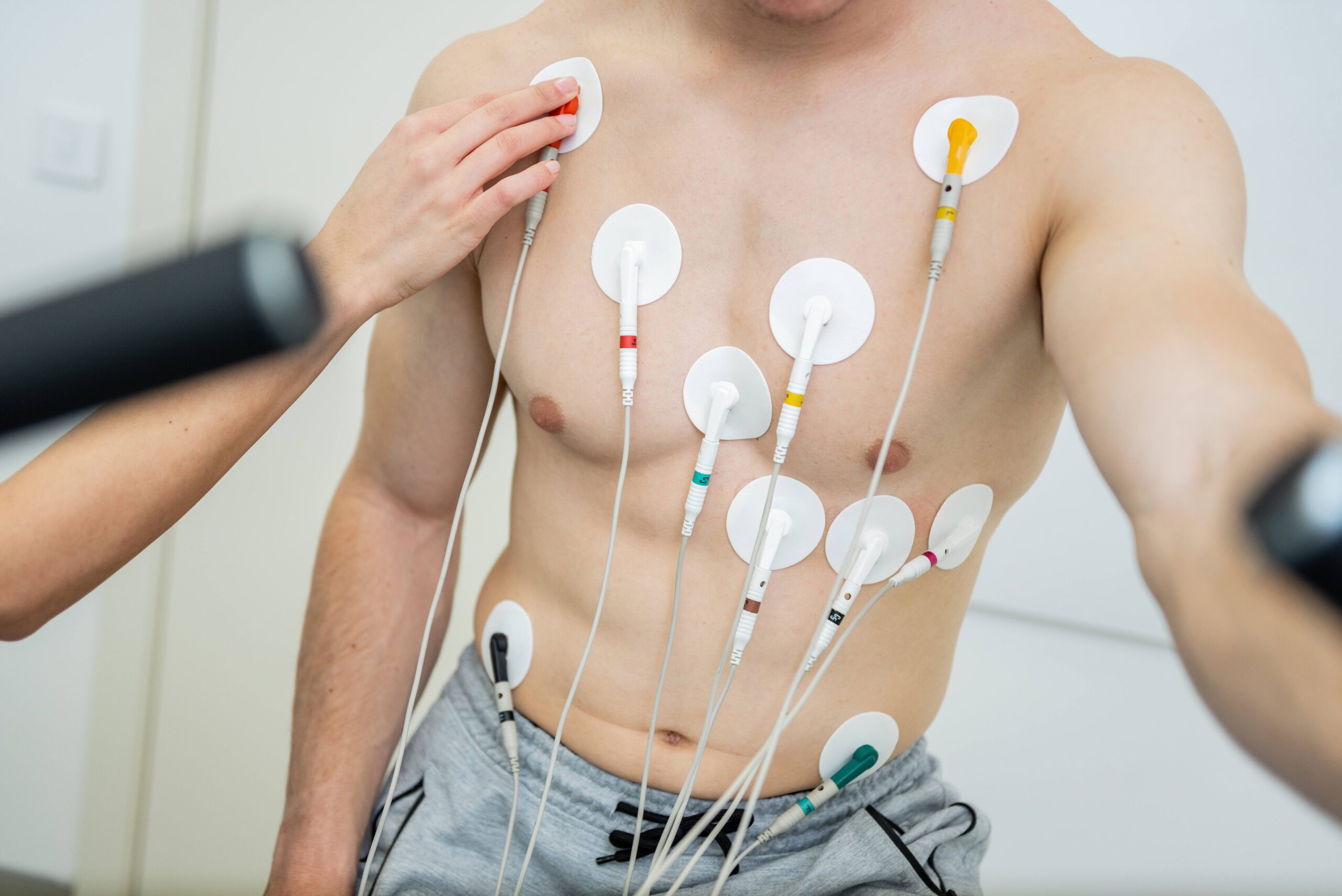 Electrical Stimulation